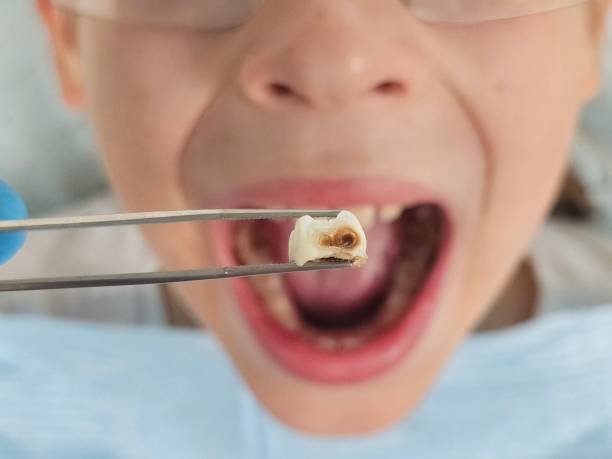 Best Broken Tooth Emergency  in Rden City, GA